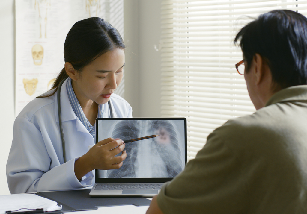 Doctor discussing lung cancer with patient